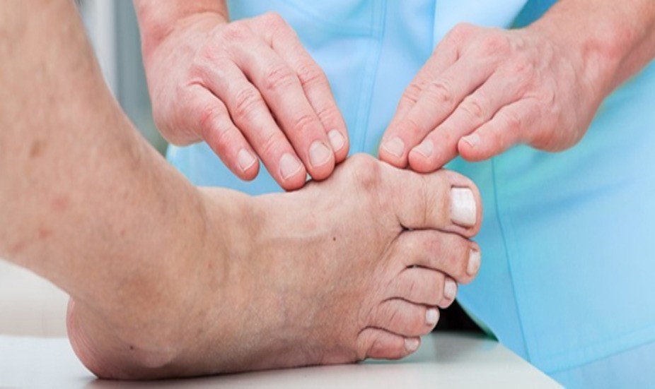 Косточка на ноге: как с ней жить, чтобы она не доставляла дискомфорта?