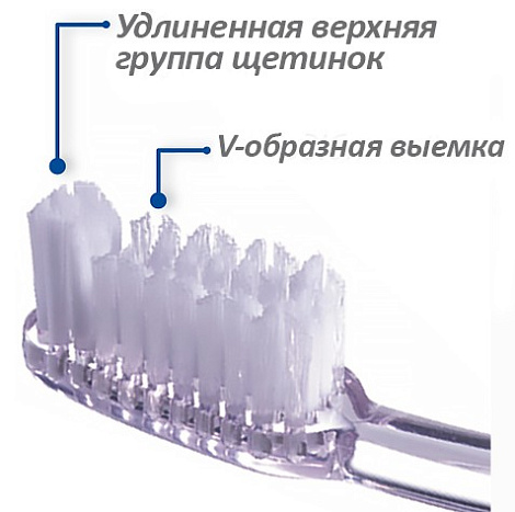 Зубная щетка ортодонтическая Vitis Orthodontic в твердой упаковке