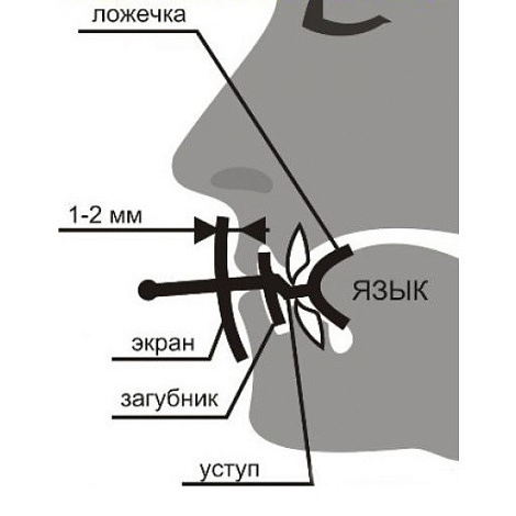 Устройство от храпа "Экстра-Лор"